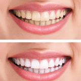 cosmetic-dentistry-services-richardson-tx